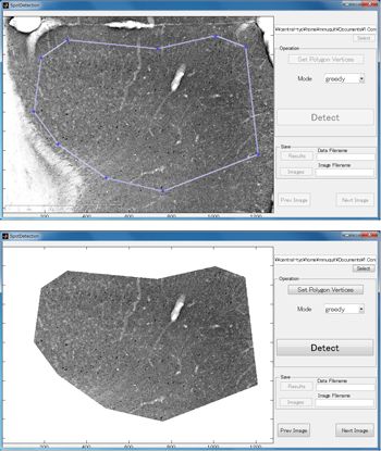 Figure 3. A region of interest marked with a polygon, used to identify the area of the image that the researcher wants to analyze.