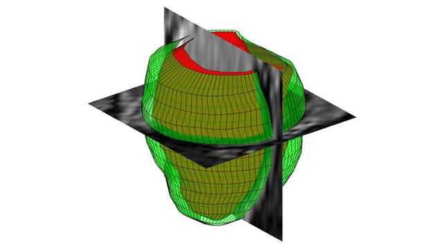 3D Image Processing