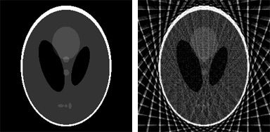 Radon reconstruction using the Shepp-Logan phantom image