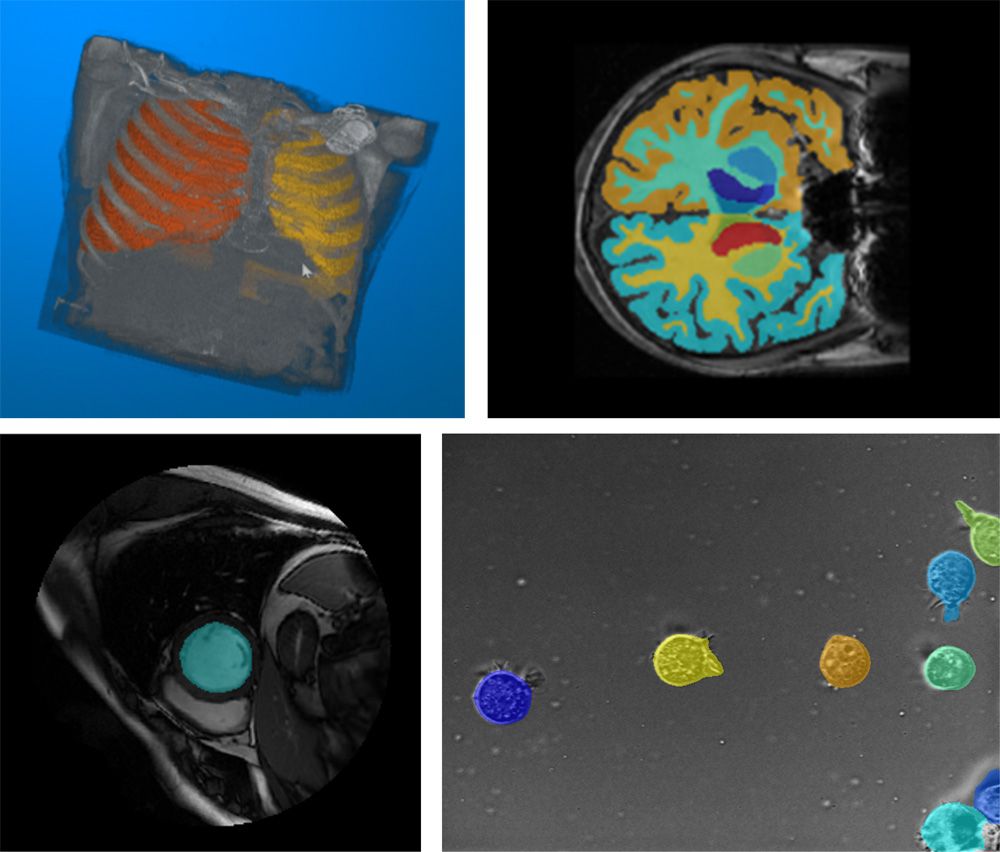 Image segmentation in Medical Imaging Toolbox shown with colored highlighting applied to identify segments.