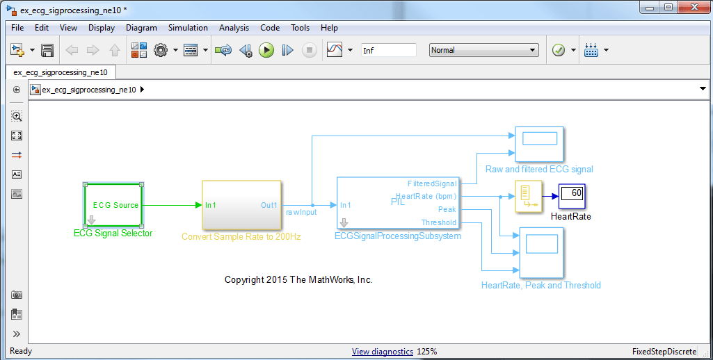 Real-Time ECG QRS Detection on ARM Cortex-A Processor