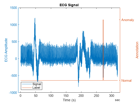 Figure contains an axes object. The axes object with title ECG Signal, xlabel Time (s), ylabel Annotation contains 2 objects of type line. These objects represent Signal, Label.