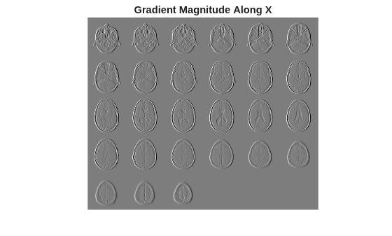 Figure contains an axes object. The hidden axes object with title Gradient Magnitude Along X contains an object of type image.