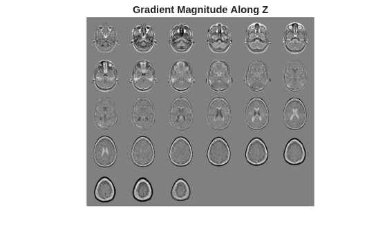 Figure contains an axes object. The hidden axes object with title Gradient Magnitude Along Z contains an object of type image.