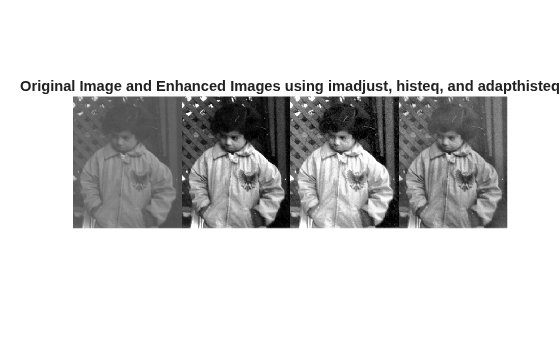 Figure contains an axes object. The hidden axes object with title Original Image and Enhanced Images using imadjust, histeq, and adapthisteq contains an object of type image.