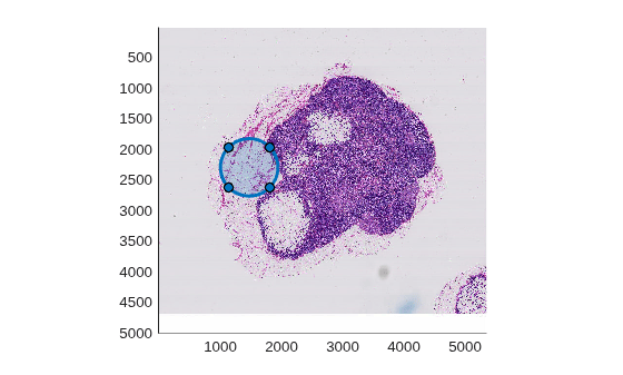 Figure contains an axes object. The axes object contains 2 objects of type bigimageshow, images.roi.circle.