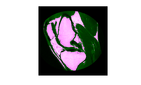 Figure contains an axes object. The hidden axes object contains an object of type image.