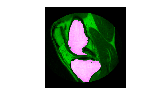 Figure contains an axes object. The hidden axes object contains an object of type image.