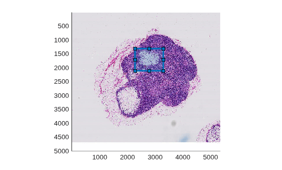 Figure contains an axes object. The axes object contains 2 objects of type bigimageshow, images.roi.rectangle.