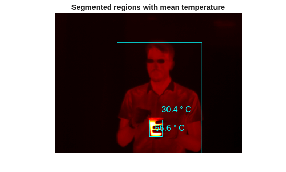 Figure contains an axes object. The hidden axes object with title Segmented regions with mean temperature contains 5 objects of type image, rectangle, text.