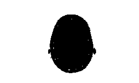 Figure contains an axes object. The hidden axes object contains an object of type image.