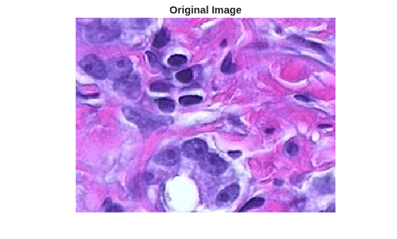 Figure contains an axes object. The hidden axes object with title Original Image contains an object of type image.