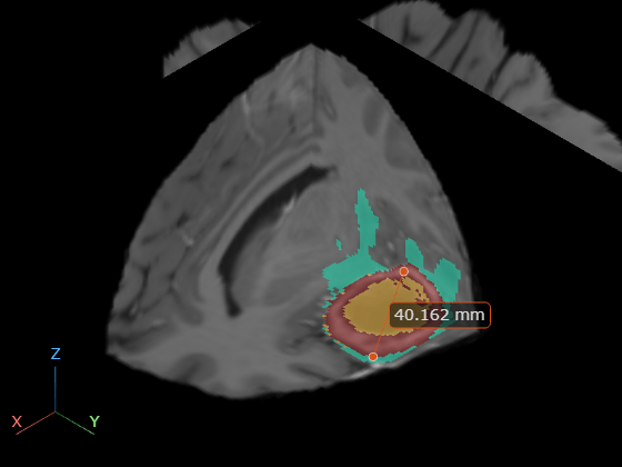 Figure contains an object of type images.ui.graphics3d.viewer3d.