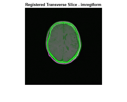 Figure contains an axes object. The axes object with title Registered Transverse Slice - imregtform contains an object of type image.