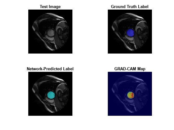 Figure contains 4 axes objects. Axes object 1 with title Test Image contains an object of type image. Axes object 2 with title Ground Truth Label contains an object of type image. Axes object 3 with title Network-Predicted Label contains an object of type image. Axes object 4 with title GRAD-CAM Map contains 2 objects of type image.