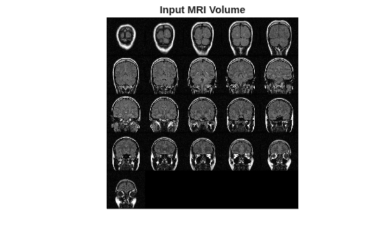 Figure contains an axes object. The hidden axes object with title Input MRI Volume contains an object of type image.