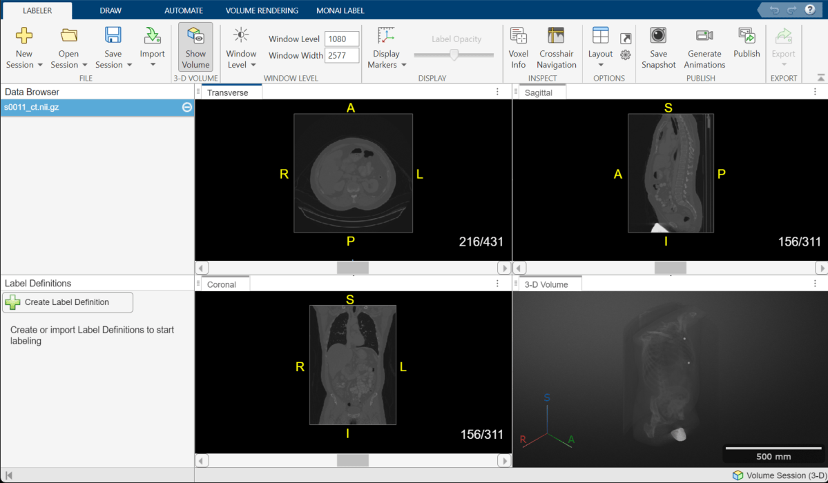 Medical Image Labeler window with a volume from the Total Segmentator data set loaded in a volume session.