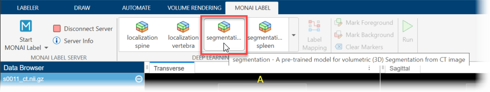 Select a MONAI Label model from the Deep Learning Models gallery in the MONAI Label tab of the app toolstrip.
