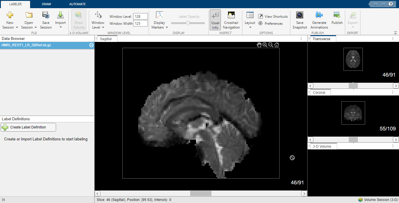 Anatomical MRI in Medical Image Labeler.