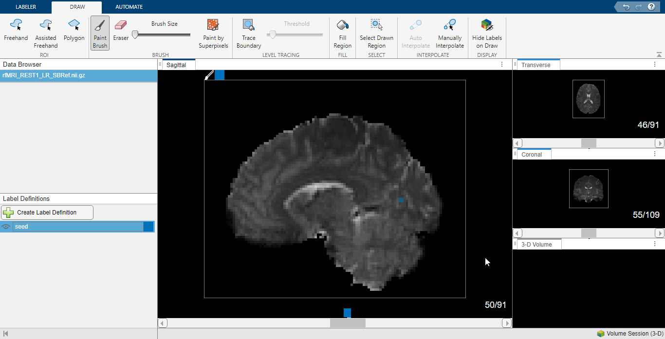 Labeled seed voxels in anatomical MRI in Medical Image Labeler.