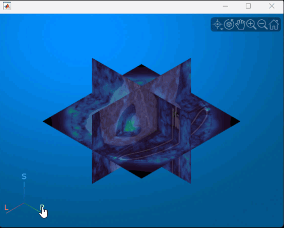 Animation showing how to view the coronal plane and scroll through the coronal slices in the interactive viewer window.