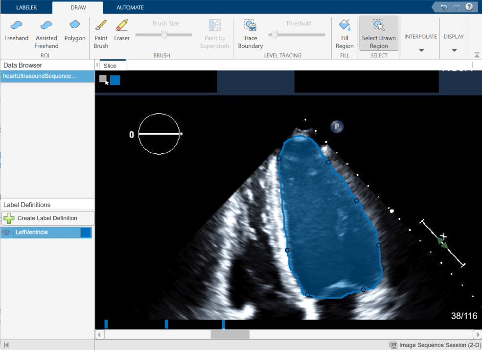 Label 2-D Ultrasound Series Using Medical Image Labeler