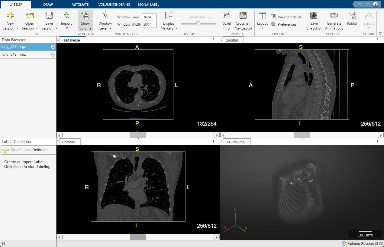 Medical Image Labeler app volume session with two chest CT scans loaded in the Data Browser