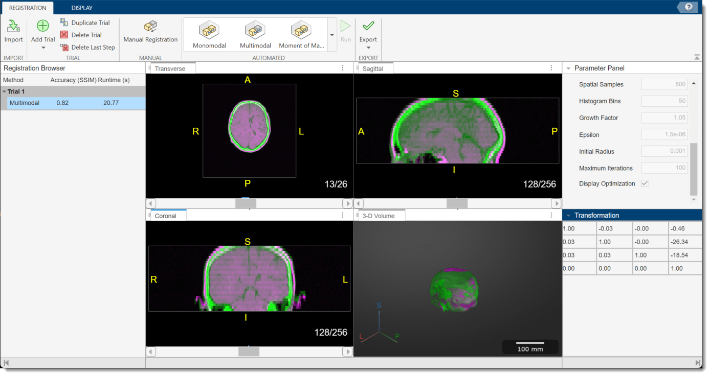 App window showing results of multimodal registration