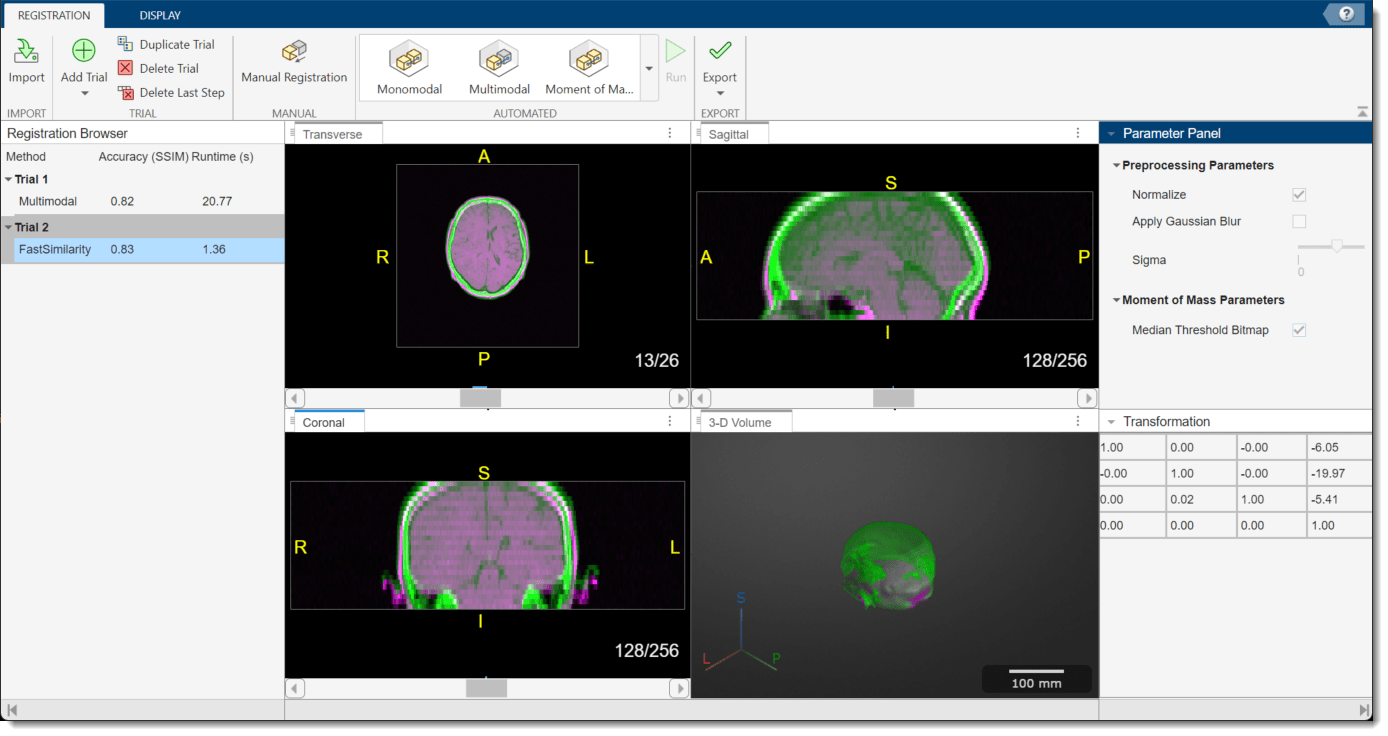 App window showing the results of Moment of Mass registration