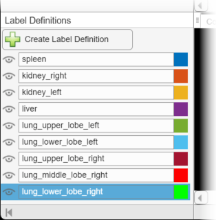 Medical Image Labeler app window showing the labels predicted by the segmentation model.