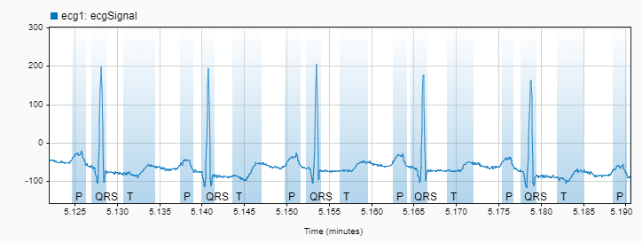 Label ECG Signals and Track Progress