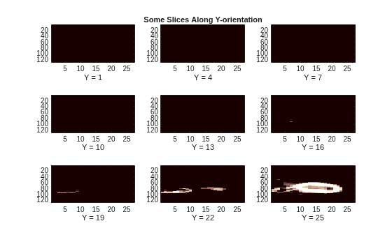 Figure contains 9 axes objects. Axes object 1 with xlabel Y = 1 contains an object of type image. Axes object 2 with title Some Slices Along Y-orientation, xlabel Y = 4 contains an object of type image. Axes object 3 with xlabel Y = 7 contains an object of type image. Axes object 4 with xlabel Y = 10 contains an object of type image. Axes object 5 with xlabel Y = 13 contains an object of type image. Axes object 6 with xlabel Y = 16 contains an object of type image. Axes object 7 with xlabel Y = 19 contains an object of type image. Axes object 8 with xlabel Y = 22 contains an object of type image. Axes object 9 with xlabel Y = 25 contains an object of type image.
