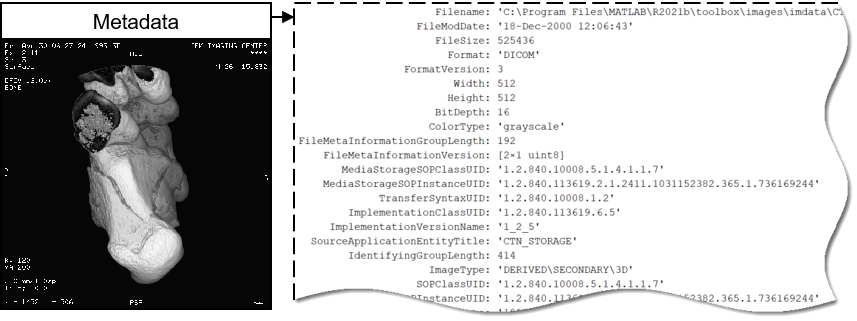 Representative DICOM file showing image data and subset of metadata attributes