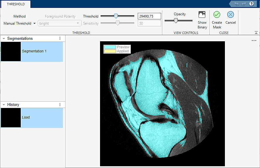 Preview of segmented knee using manual thresholding.