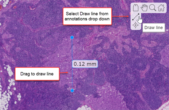 The viewer window, showing how to add line annotations for measuring distances between two points