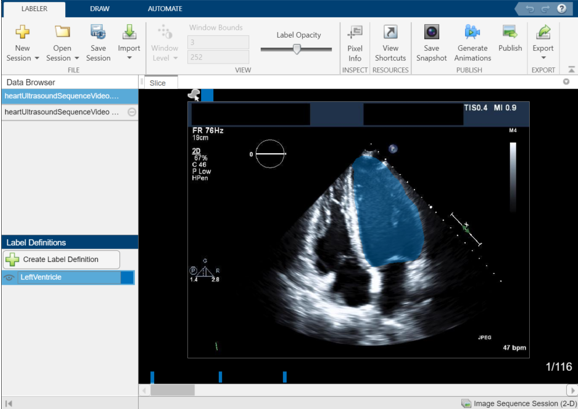 Medical Image Labeler image session