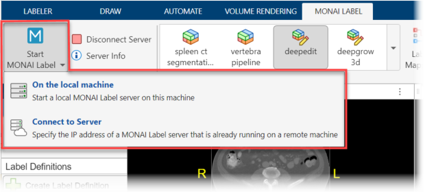 Medical Image Labeler window showing the Start MONAI Label button