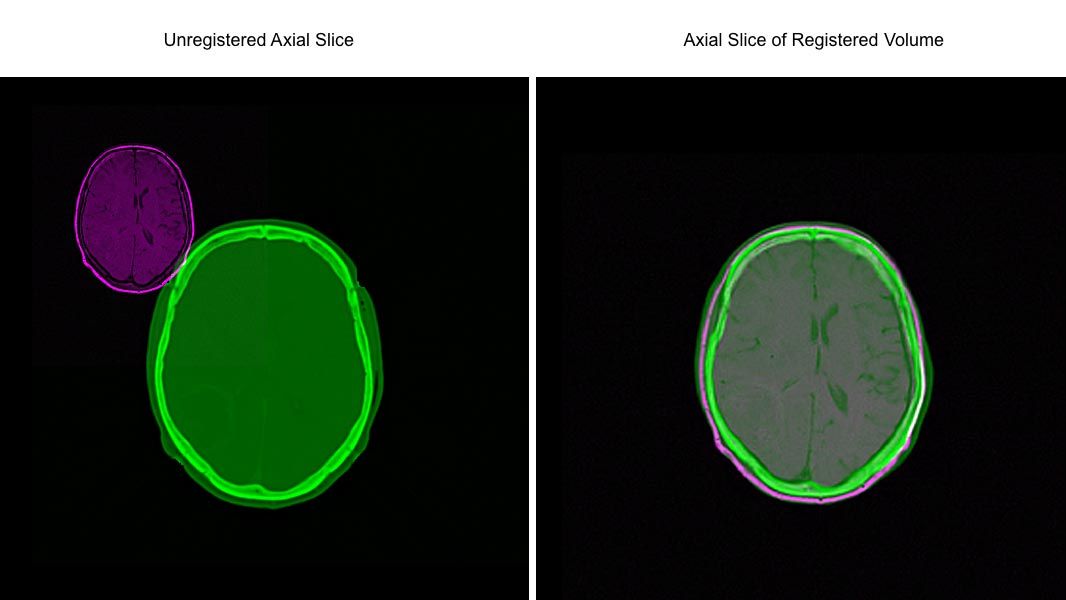 This example shows how you can automatically align two volumetric data sets using intensity-based registration.