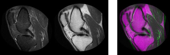 Automatic registration on multimodal medical images Automatic registration on multimodal medical images
