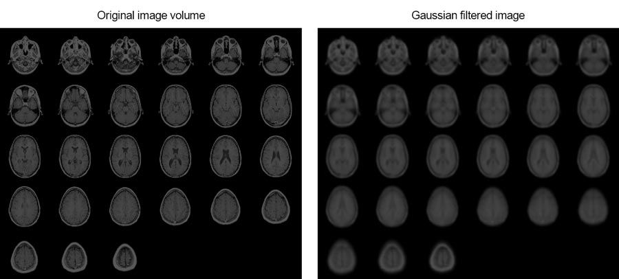 This example shows how you can smooth MRI images of a human brain using 3D Gaussian filtering.